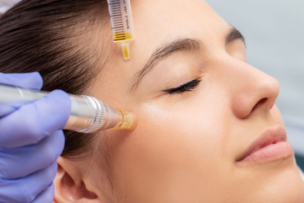 PRP Treatments Near Me | Allora Medical Spa Dallas