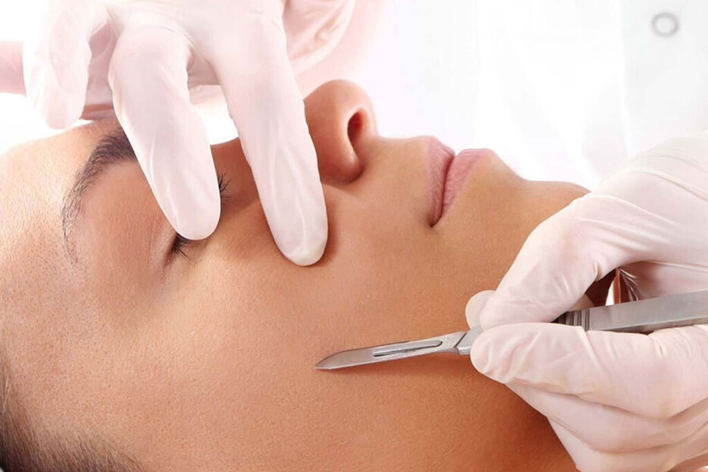 Dermaplaning Near Me | Allora Medical Spa Dallas