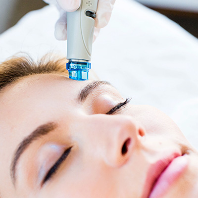 Microneedling near me